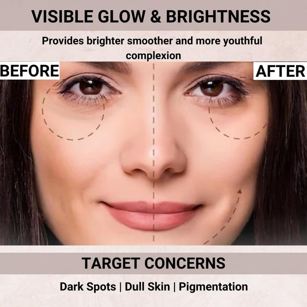 Glow Boosting Under Eye Cream | Gel for Dark Circles: Ark Natural